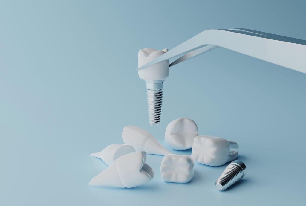 3d-rendering-dental-implantation-concept-human-teeth-dentures-tools-scaled