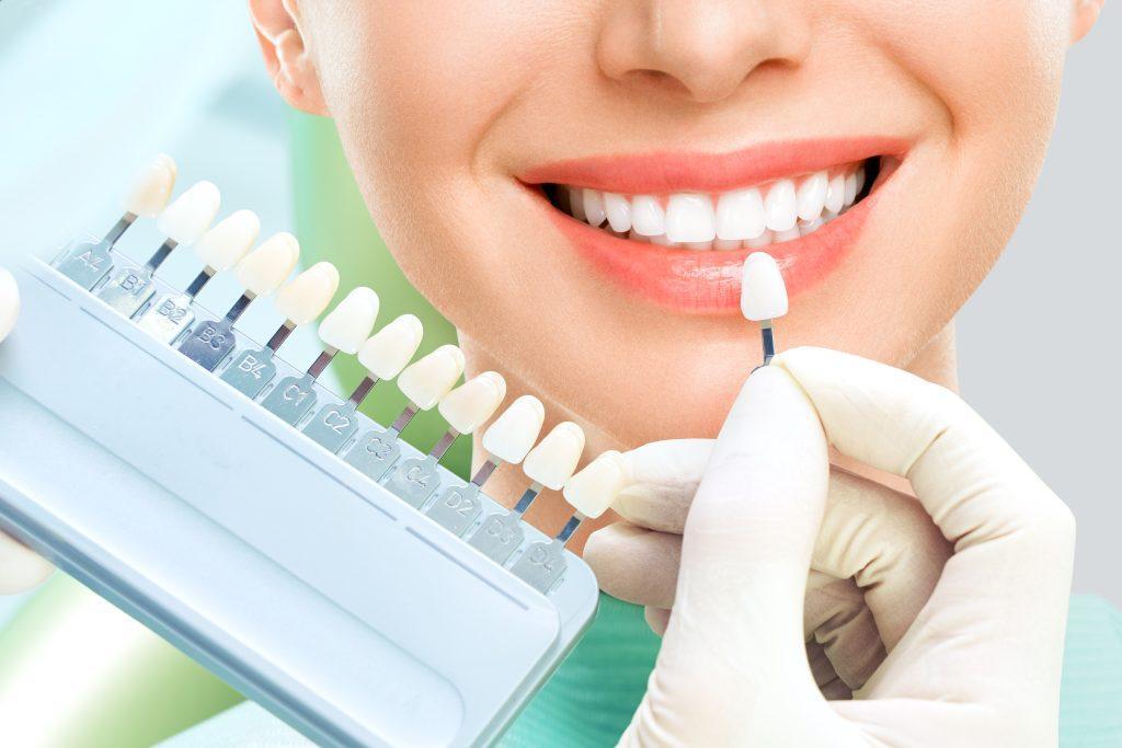 close-up-portrait-young-women-dentist-chair-check-select-color-teeth-dentist-makes-process-treatment-dental-clinic-office-teeth-whitening-scaled