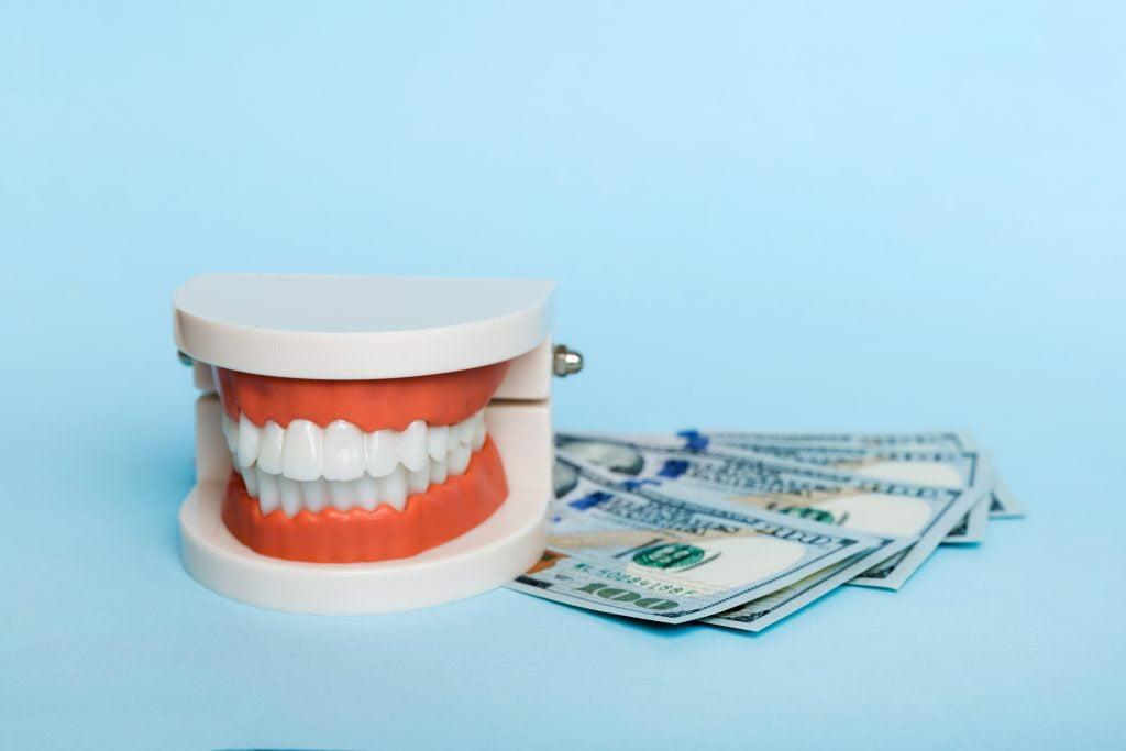 closeup-model-human-jaw-with-white-teeth-dollar-bill-dentistry-conceptual-photo-prosthetic-dentistry-false-teet-top-view-with-copy-space-scaled