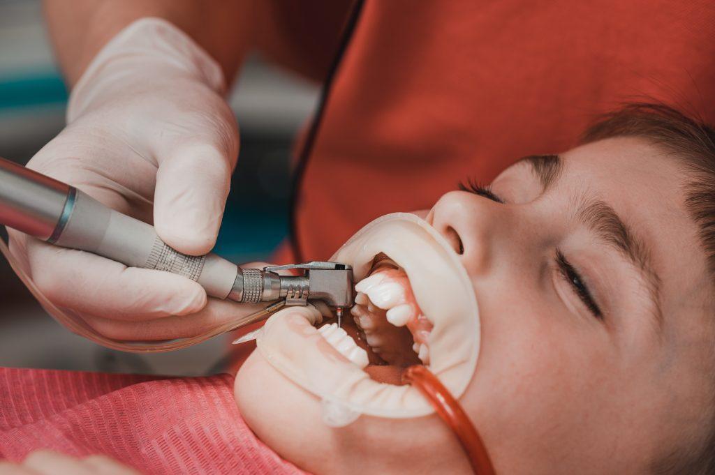 dentist-cleans-tooth-decay-child-with-drill-child-s-mouth-ejector-saliva-scaled