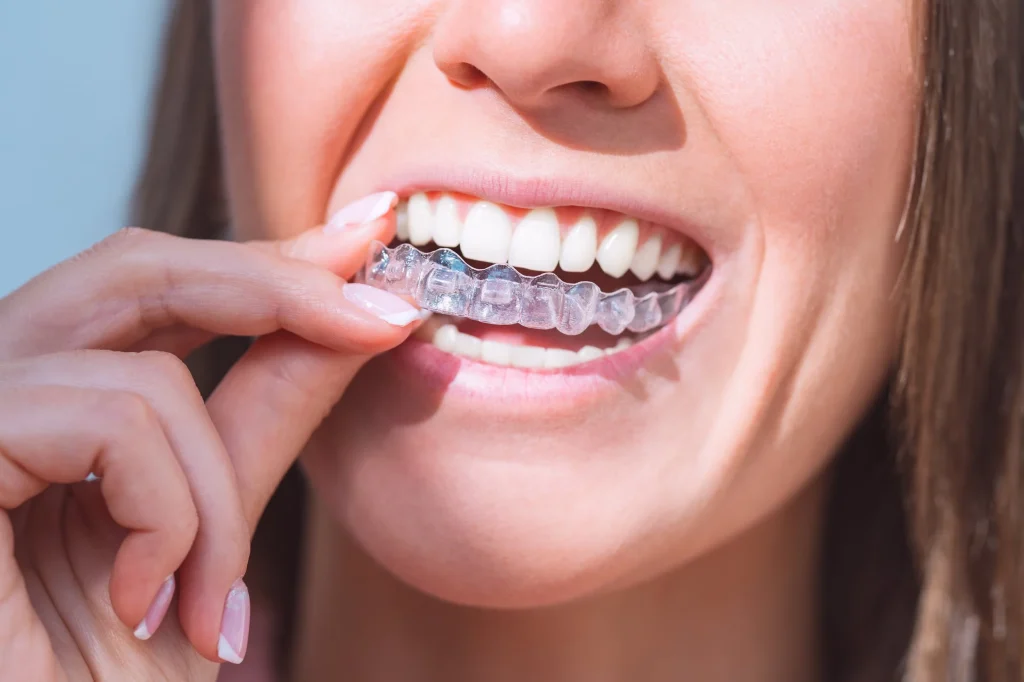Gentle, Confident Smiles with Invisalign in Olive Branch Indianapolis