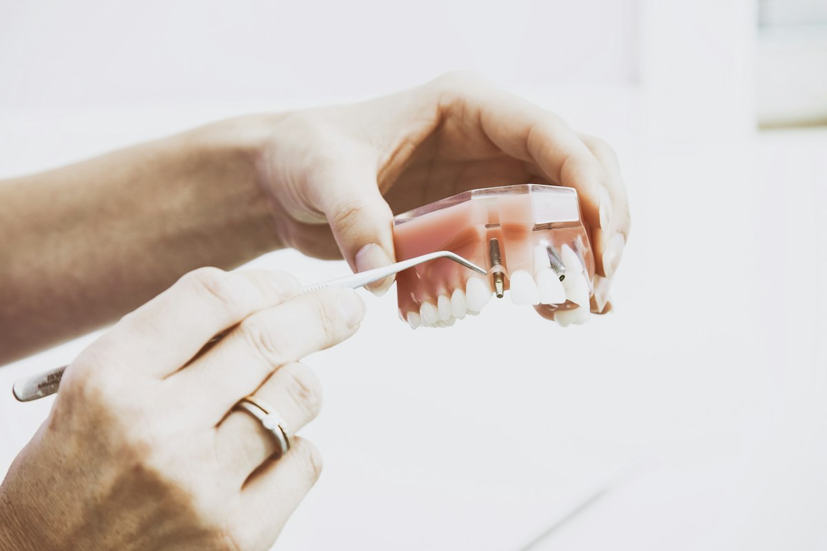 Implant dentist in Indianapolis comparing dental implants and dentures