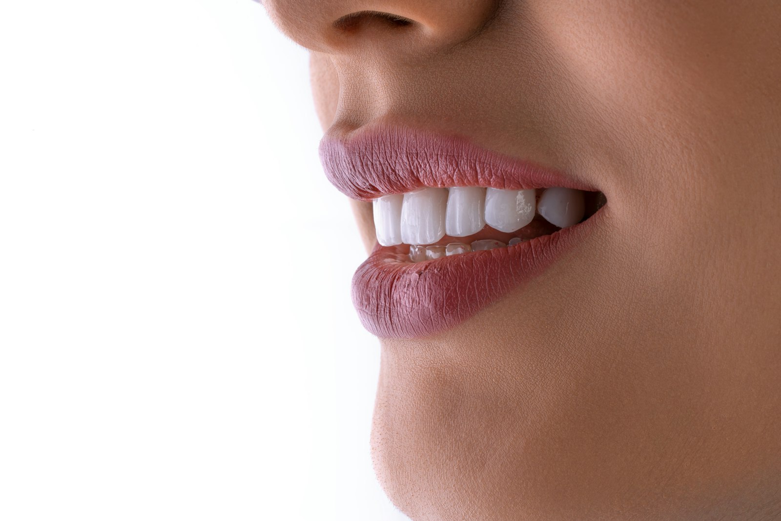 Close-up of a bright smile after proper porcelain veneer care